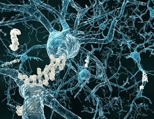 Researchers map proteo-genomic connections between different human diseases