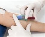 Study Links Extracellular Vesicles to Blood Vessel Damage in Cancer