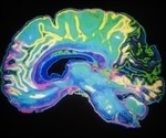 New Frontier in Understanding Brain Development and Rare Diseases