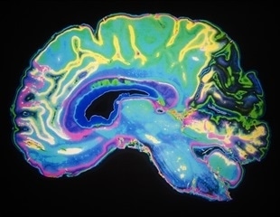 New Frontier in Understanding Brain Development and Rare Diseases