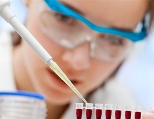Simple blood test is useful in screening youth for prediabetes and diabetes