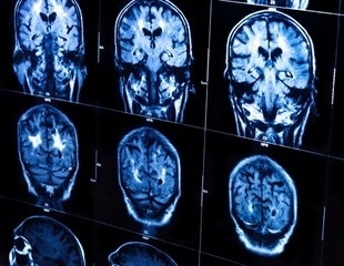New two-photon microscope provides unprecedented brain-imaging ability