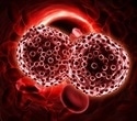 Genome-Wide Screening Approach Uncovers Genetic Brakes on Blood Cancer Growth