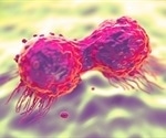 Study confirms the efficacy of PSMA PET/CT in detection and management of recurrent prostate cancer
