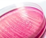 New Insights on Factors Influencing E. coli Contamination on Leafy Greens