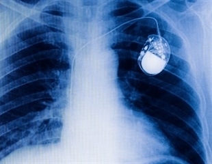 Computational Tool Maps the Dance of Circadian Synchrony