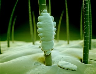 Diagnosing and Treating Borrelia recurrentis Infections in Refugee Populations