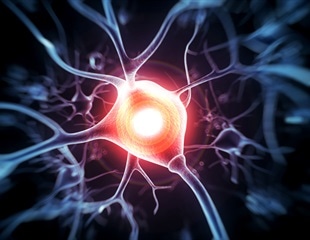 Necroptosis Emerges as a Key Target in Alzheimer's Disease