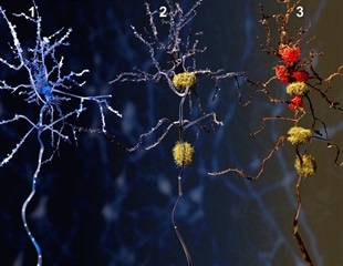 Unveiling Mechanisms to Block Tau Aggregation