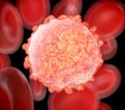 Genome-Wide Screening Approach Uncovers Genetic Brakes on Blood Cancer Growth