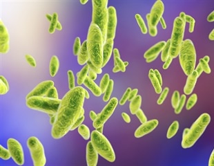Researchers Discover Link Between Neolithic Farming and Brucellosis