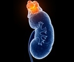 In-depth study of kidney tumors reveals novel markers of response to immunotherapy