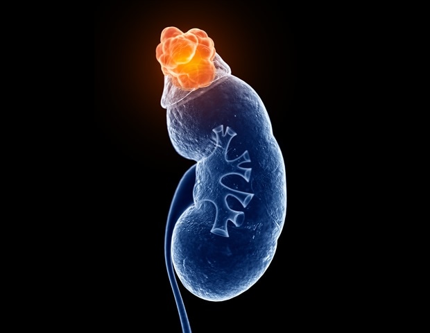 Elevated Glucose Levels Cause Vital Epithelial Cells to Detach in Organoids