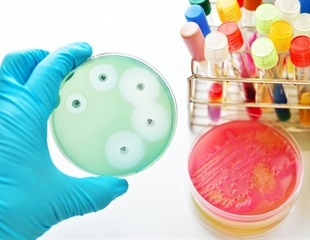 New Way to Conduct Extensive Proteome Analysis of Urine