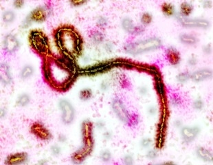 Cryo-Electron Microscopy Reveals Structure of Borna Virus RNA Protein Complex