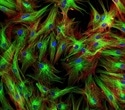 Stage-Dependent Gene Expression Changes Reveal Cellular Aging Dynamics