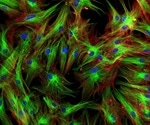 Johns Hopkins Team Identifies Distinct Subtypes of Senescent Skin Cells