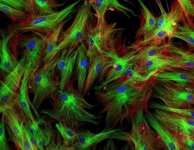 Targeting Fibroblast Communication Could Halt Primary Sjögren Disease Damage