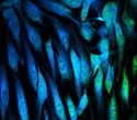 Stage-Dependent Gene Expression Changes Reveal Cellular Aging Dynamics