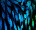 Johns Hopkins Team Identifies Distinct Subtypes of Senescent Skin Cells