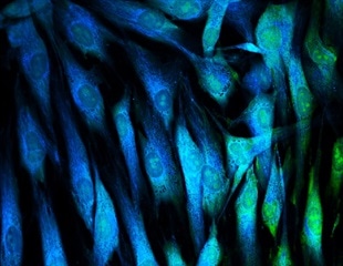 Johns Hopkins Team Identifies Distinct Subtypes of Senescent Skin Cells