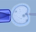 AI Partnership Aims to Personalize IVF Treatment, Improve Patient Outcomes
