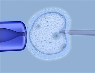 AI Partnership Aims to Personalize IVF Treatment, Improve Patient Outcomes