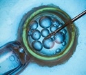 AI Partnership Aims to Personalize IVF Treatment, Improve Patient Outcomes