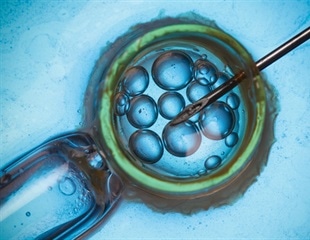 AI Partnership Aims to Personalize IVF Treatment, Improve Patient Outcomes
