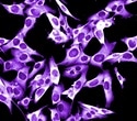 Cancer Cell Deformability Drives Movement Through Tight Tissue Gaps