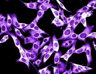 Mitochondrial RNA May Explain How Tumors Become Resistant to Immunotherapy