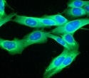 Cancer Cell Deformability Drives Movement Through Tight Tissue Gaps