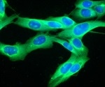 Research sheds new light on immune system interactions with cancer