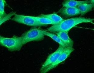 New Hybrid Compounds Fight Aggressive Cancers and Infections
