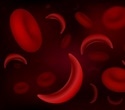 New Gene-Editing Approach Eliminates Painful Crises in Sickle Cell Disease                                                    New Results From A Clinical...
