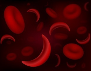 Terumo Blood and Cell Technologies Presents Data on Automated Red Blood Cell Exchange to Treat Sickle Cell Disease at the American Society of Hematology
