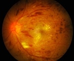 Scientists Unveil Dynamic Structure of Vision-Linked Protein RBP3