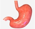 EBV viral genome modifies the host epigenetic landscape to promote gastric cancer