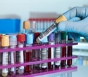 Proteomic Profiling Uncovers Twenty-Four Plasma Proteins Tied to Gut Mucosal Inflammation