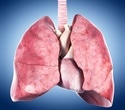 Spatial Single-Cell Transcriptomics Maps Cellular Niches in Fatal COVID-19 Lungs