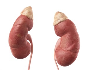 Unveiling the Protective Role of KLF6 in Diabetic Kidney Disease