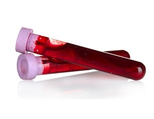 New Test Scrutinizes All Fetal Genes for Early Disease Detection