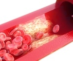Breakthrough 3D Vascular Sheet Mimics Atherosclerosis for High-Throughput Drug Screening