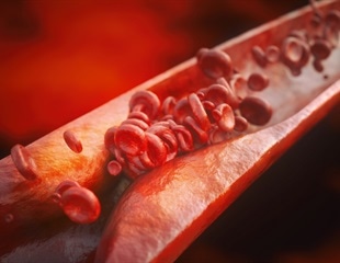 New Genetic Targets for Atherosclerosis Prevention