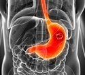 New study breaks down the risk of stomach cancer in non-white Americans