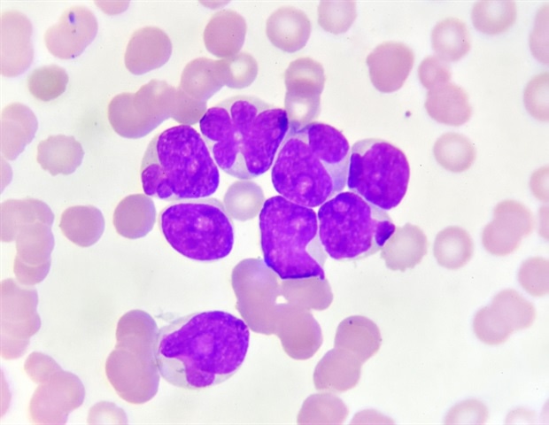 Dual Genetic Mutations Drive RNA Mis-Splicing and Leukemia Progression