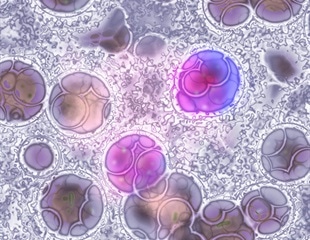 Herpesvirus infection boosts host cellular immunity: Study