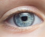 Pig Retinal Organoids Offer Promising Model for Stem Cell-Based Vision Therapies