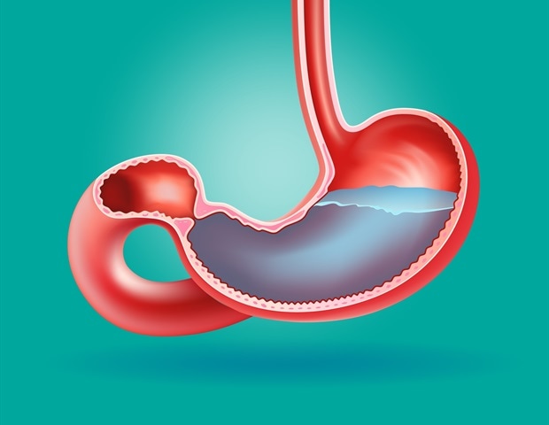 High Stomach Regeneration Rates Can Trigger Tumor Development