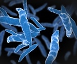 Unveiling the Mechanisms of Phenotypic Heterogeneity in M. tuberculosis